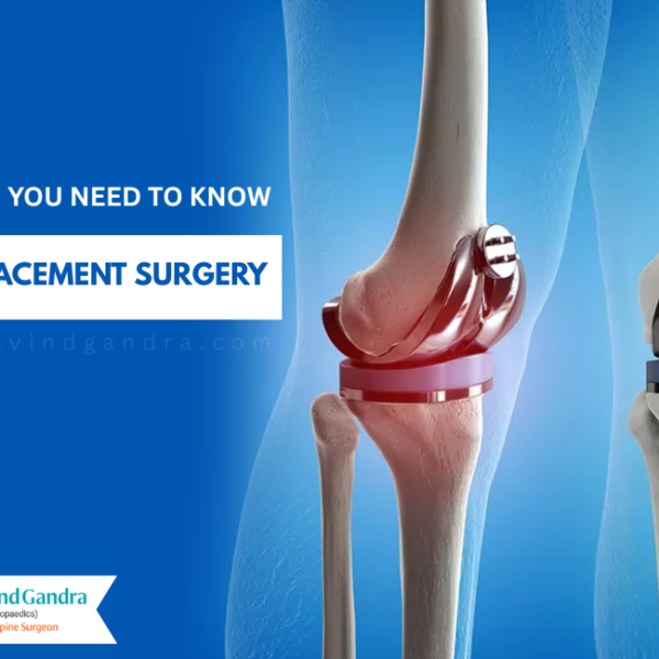 Knee Replacement Surgery
