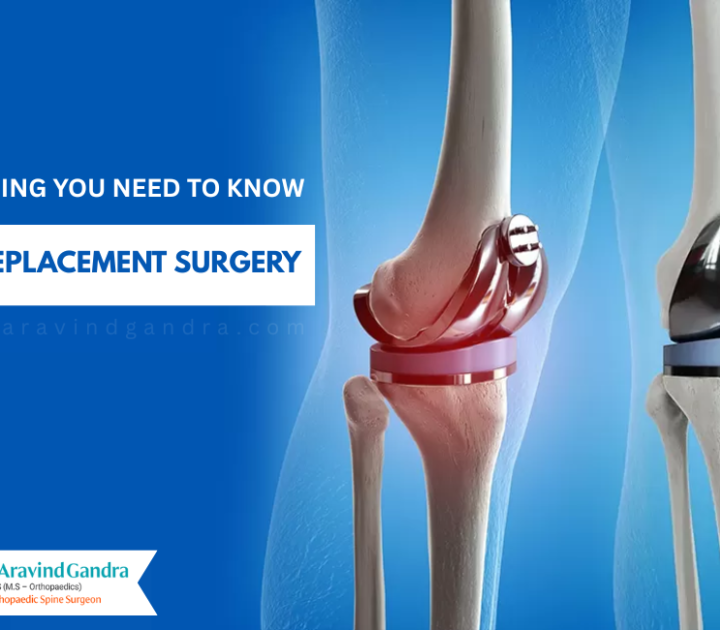 Knee Replacement Surgery