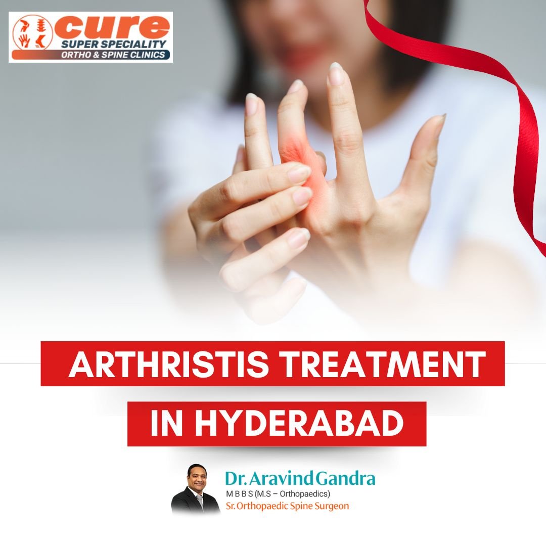 Arthritis Treatment in Hyderabad