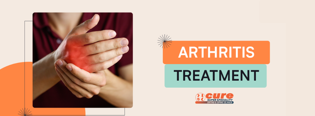 Arthritis Treatment in Hyderabad