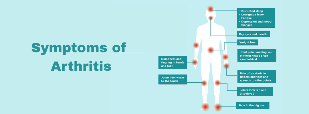 Symptoms of Arthritis