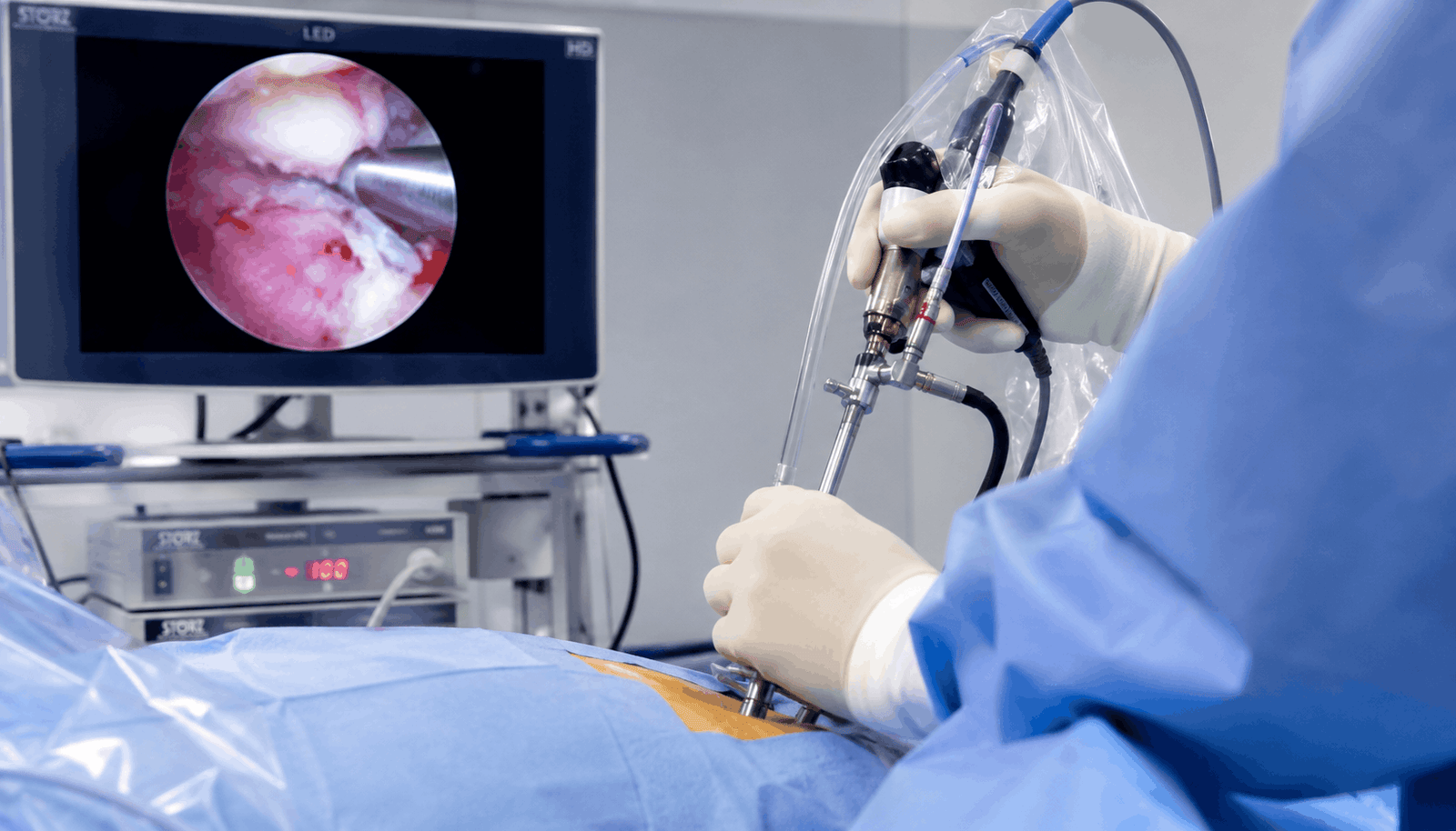 Endoscopic spine surgery