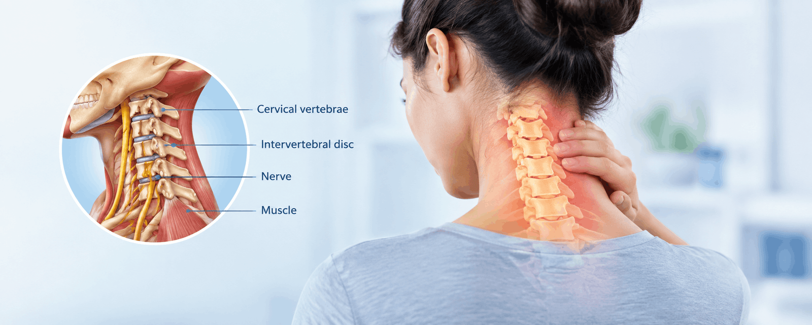 Neck Pain